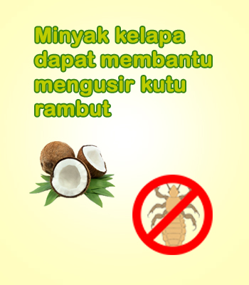 VCO mengusir kutu rambut