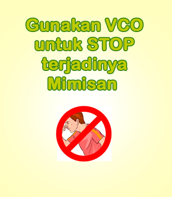 cara mengatasi mimisan dengan alami